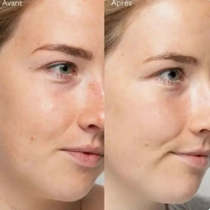 Lumiskin AYLI® Baguette de soin du visage 4 en 1