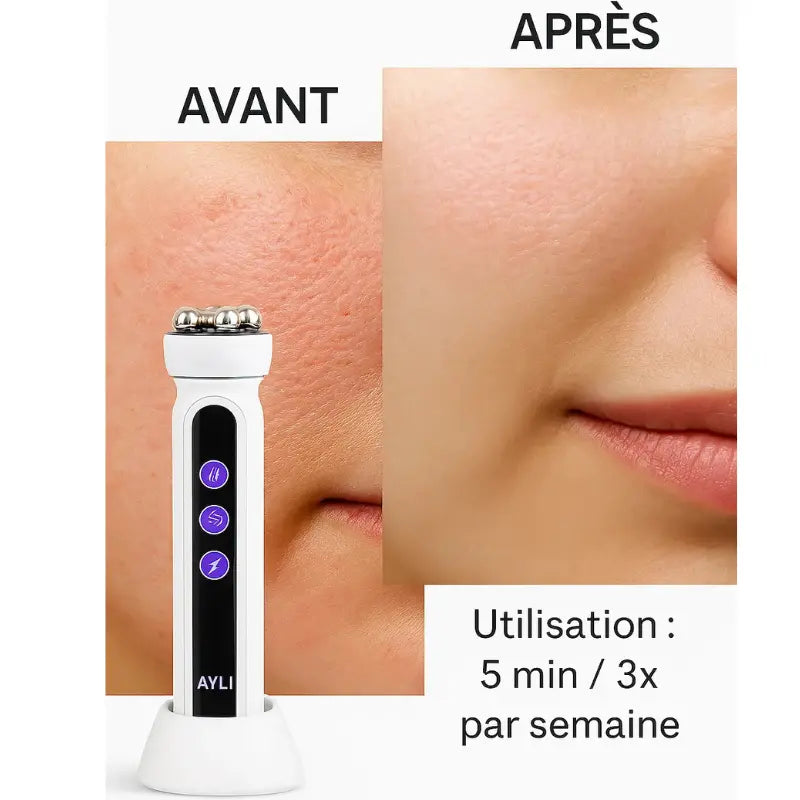 ContourLift 3-en-1 AYLI®