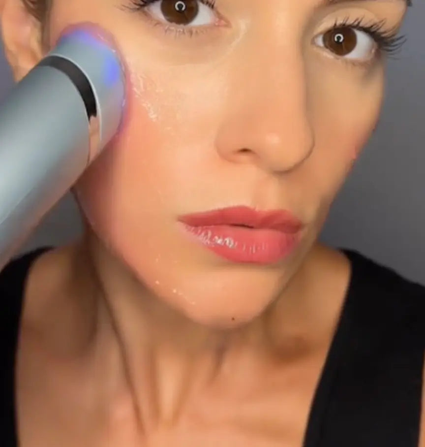 Utilisation de l'appareil HIFU LiftPro sur le visage pour raffermir la peau à domicile - Avis Linda G.