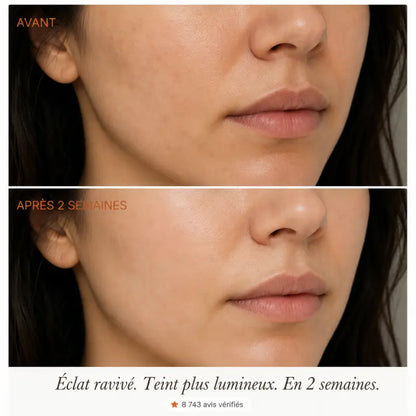 Comparaison avant après de l'éclat du visage avec LUMINA