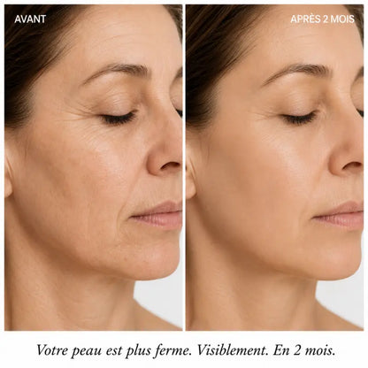 Comparaison avant après de la fermeté du visage avec LUMINA
