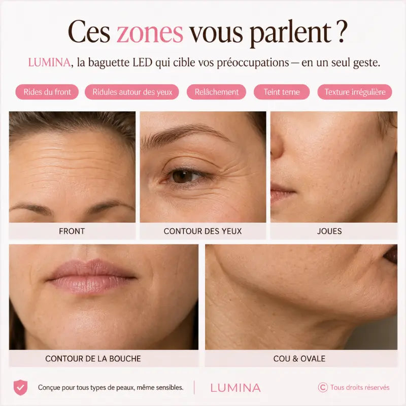Cinq zones du visage ciblées par LUMINA : front, contour des yeux, joues, bouche, cou